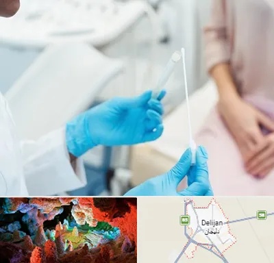 دکتر زگیل تناسلی HPV در دلیجان