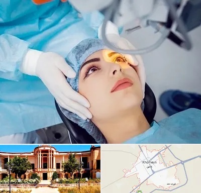 دکتر عمل لیزیک چشم در خمین