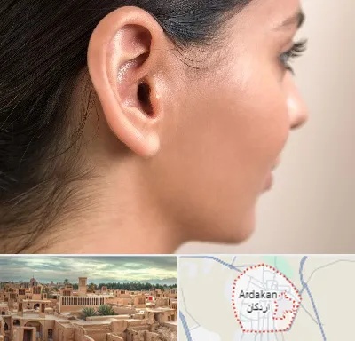 عمل گوش بل در اردکان