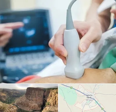 اکو قلب شبانه روزی در سرپل ذهاب
