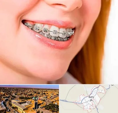 ارتودنسی ارزان در بافق