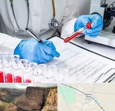 آزمایشگاه اعتیاد در سرپل ذهاب