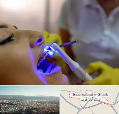دندانپزشکی با لیزر در اسلام آباد غرب