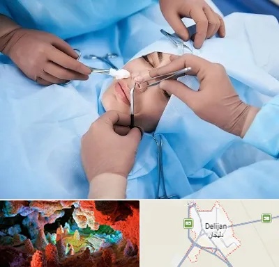 عمل بینی فانتزی در دلیجان