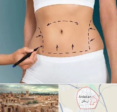 دکتر طب سنتی برای لاغری در اردکان