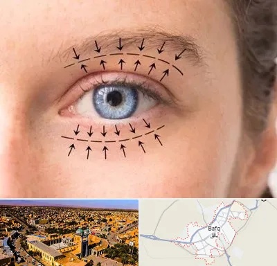 عمل افتادگی پلک در بافق