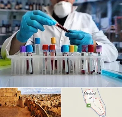 آزمایشگاه خون در میبد