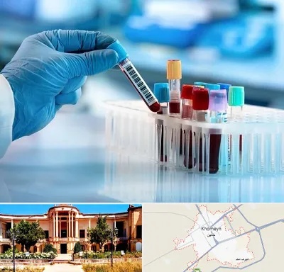 آزمایشگاه خون قبل از ازدواج در خمین