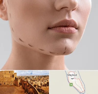 عمل زاویه فک در میبد