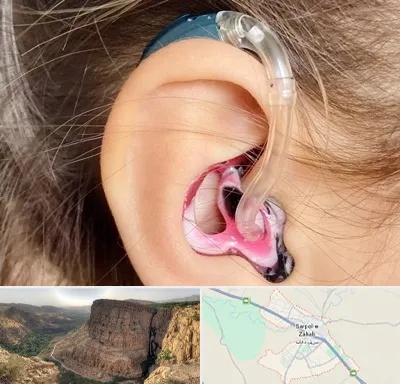 ساخت قالب سمعک در سرپل ذهاب
