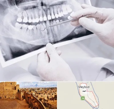 رادیولوژی دهان و دندان در میبد
