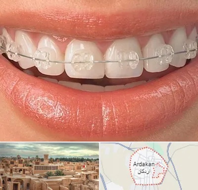 ارتودنسی اقساطی در اردکان