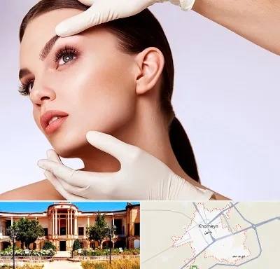 دکتر رفع غبغب در خمین