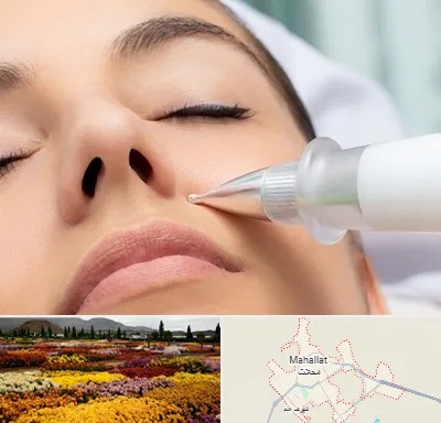 پلاسما جت بینی در محلات