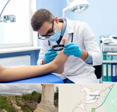درمان زخم پای دیابتی در کنگاور