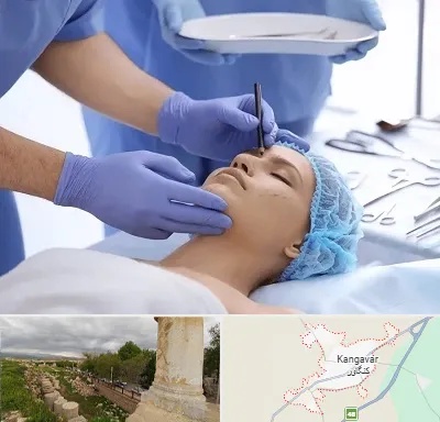 عمل بینی طبیعی در کنگاور