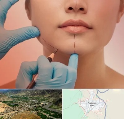 دکتر زیبایی خانم در اسدآباد
