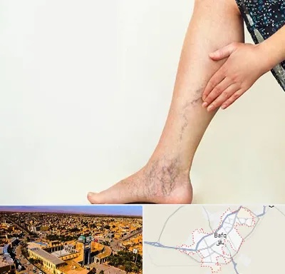 دکتر واریس در بافق