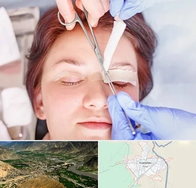 جراحی پلک افتاده در اسدآباد