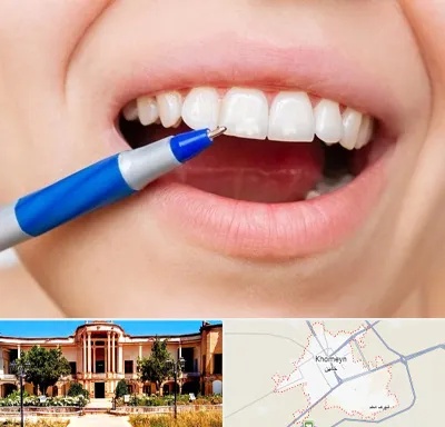 دندانسازی ارزان در خمین