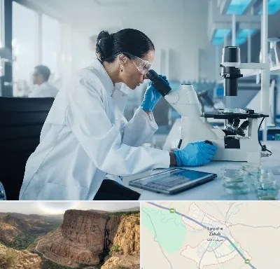 آزمایشگاه HPV در سرپل ذهاب
