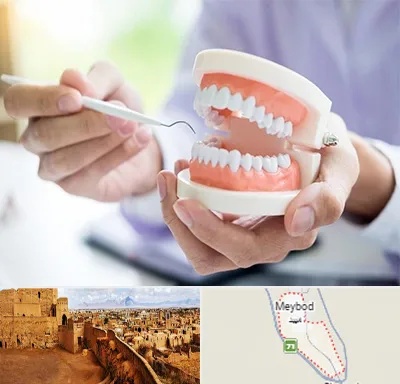 دندانسازی در میبد