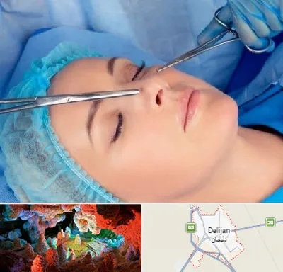 عمل بینی نیمه فانتزی در دلیجان