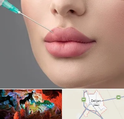 کلینیک ژل لب روسی در دلیجان