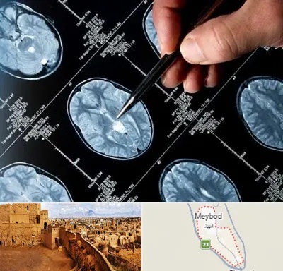 دکتر تشنج در میبد