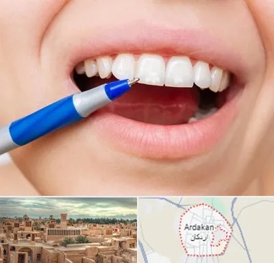 دندانسازی ارزان در اردکان