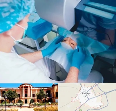 دکتر عمل لازک چشم در خمین