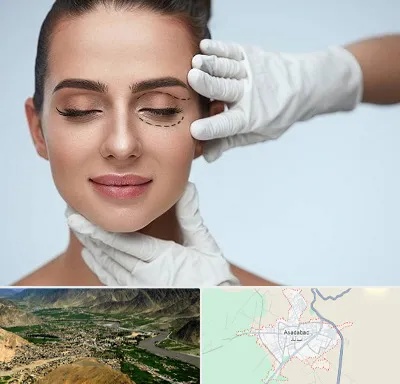 عمل پف چشم در اسدآباد