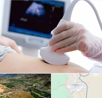 سونوگرافی در اسدآباد