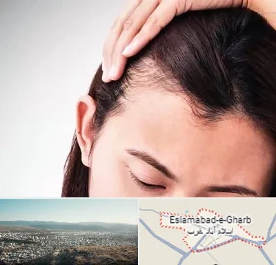 کاشت مو بانوان در اسلام آباد غرب