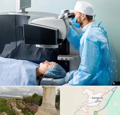 مرکز لیزیک چشم در کنگاور