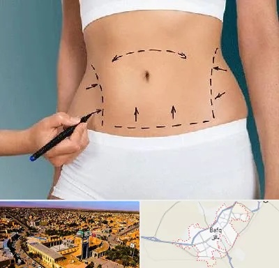 دکتر طب سنتی برای لاغری در بافق