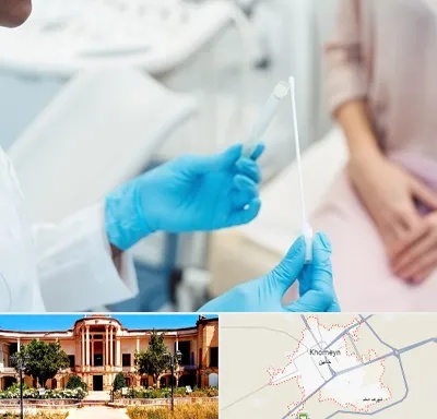 دکتر زگیل تناسلی HPV در خمین
