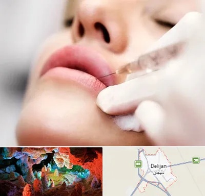 کلینیک تزریق ژل لب در دلیجان