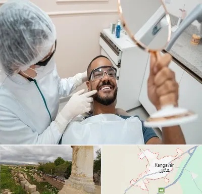 ایمپلنت فوری در کنگاور