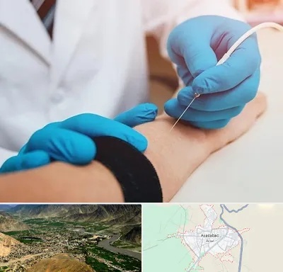 مرکز نوار عصب و عضله در اسدآباد