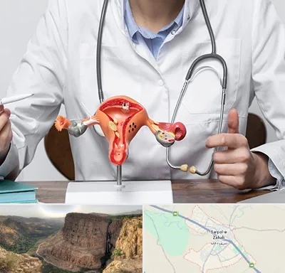 جراح سرطان رحم در سرپل ذهاب