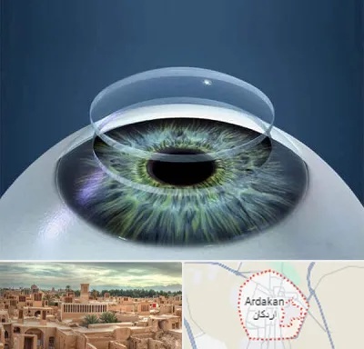 پیوند قرنیه در اردکان