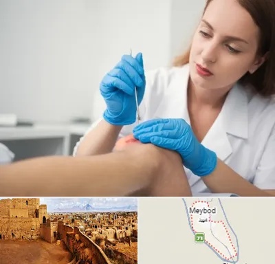 متخصص زخم در میبد