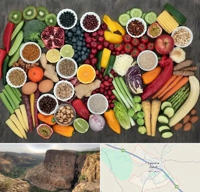 دکتر تغذیه برای چاقی در سرپل ذهاب