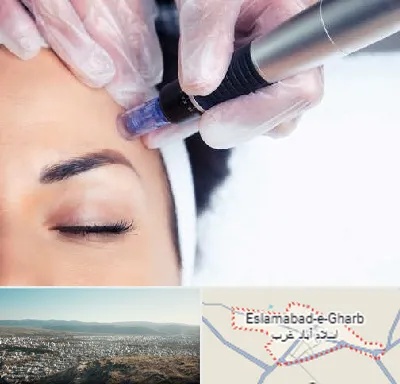 کلینیک مزوتراپی صورت در اسلام آباد غرب