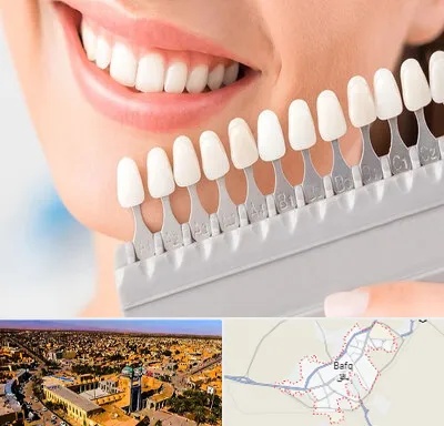 متخصص لمینت دندان در بافق