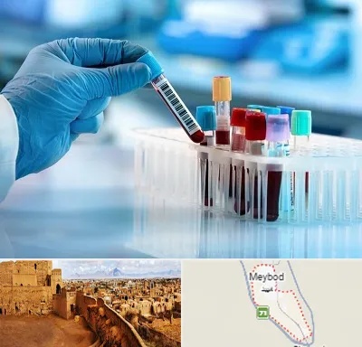 آزمایشگاه خون قبل از ازدواج در میبد