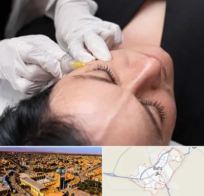 کربوکسی تراپی در بافق