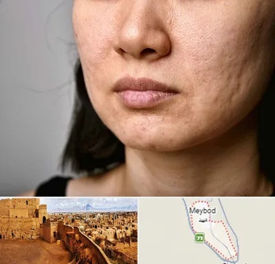 سابسیژن جای جوش در میبد