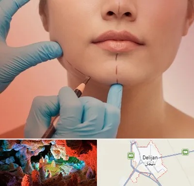 دکتر زیبایی خانم در دلیجان